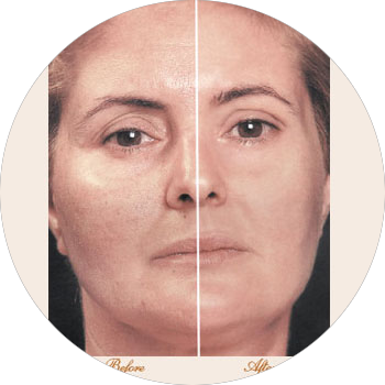 SKIN-MASTER-SKIN-REJUVENATION-SYSTEM
